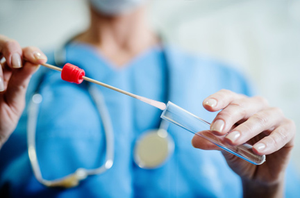 Herstellungsverfahren für einen medizinischen Beflockungs-Probenahmetupfer